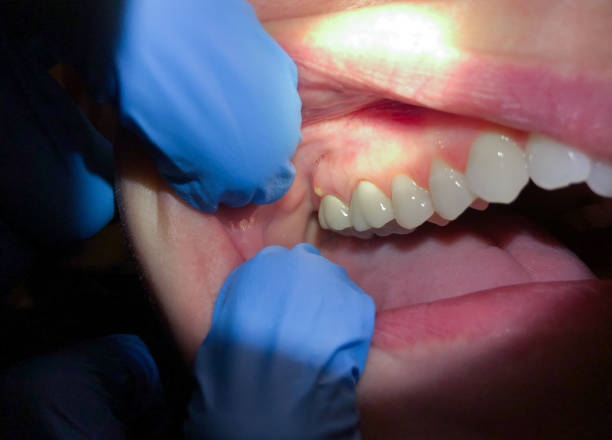Best Emergency Dental Services Near Me  in Russellville, AR