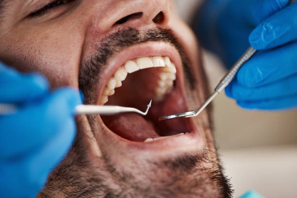 Best Emergency Dentist Open Today  in Russellville, AR